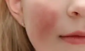 Примета: к чему чешется левая щека у женщины, девушки, мужчины в разных ситуациях