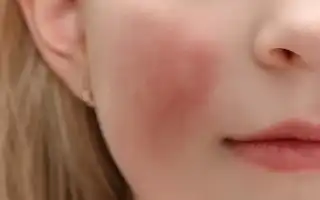 Примета: к чему чешется правая щека у женщины, девушки и мужчины в разных ситуациях