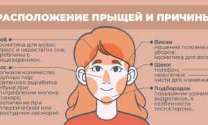 К чему прыщи на подбородке у женщины, девушки, мужчины: примета и значение