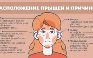 К чему прыщи на подбородке у женщины, девушки, мужчины: примета и значение