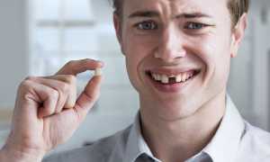 К чему снится во сне выпавший зуб: что обязательно случится в жизни