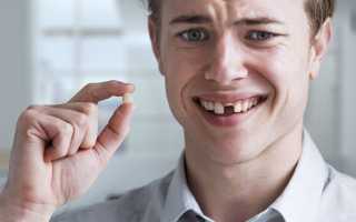 К чему снится во сне выпавший зуб: что обязательно случится в жизни