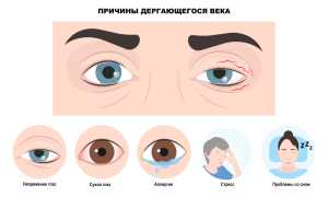 К чему дёргается левый глаз по примете и что это означает