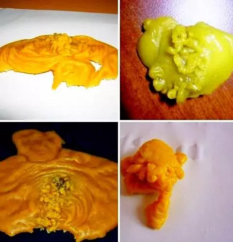 определить сглаз