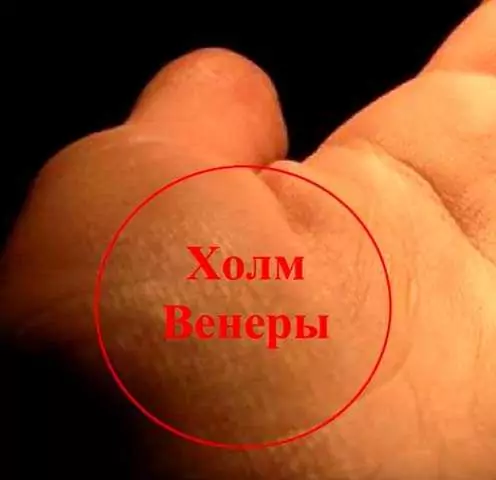 линии на холмах, показывающее беременность